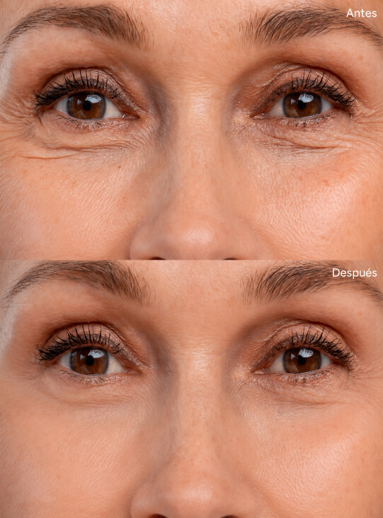ANTES Y DESPUES 4